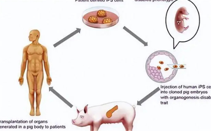 人类长寿或许成真 猪肾脏移植即将成功（肾脏移植）