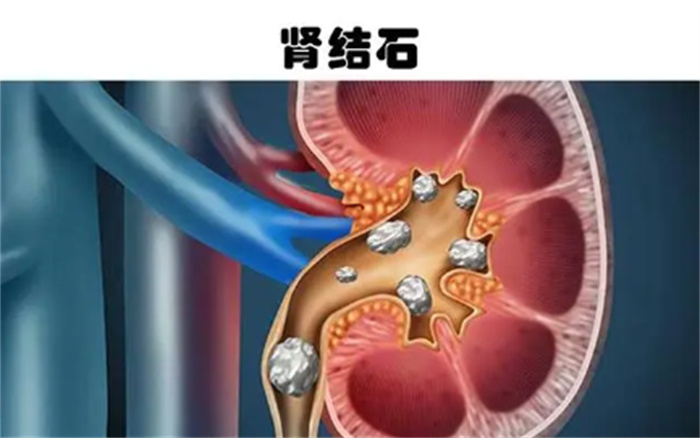 眼睛受到灼伤有多痛 人类所能经历的5件最严重的痛苦