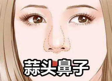 女人蒜头鼻面相好不好  蒜头鼻的女人能娶吗（非常能）