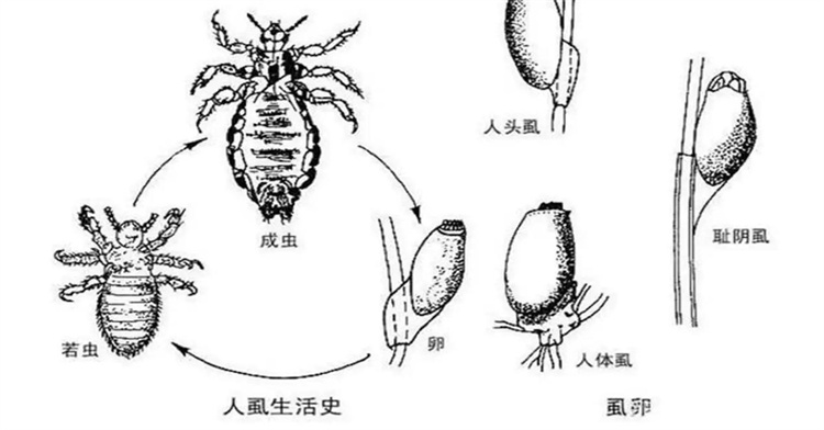 二十多年前频繁地出现在人类身上 如今几乎很难找到（虱子）