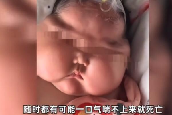 “用抑菌霜变大头娃”女婴父亲否认炒作:借视频提醒网友