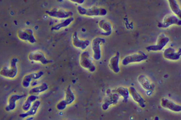 食脑虫会吃人脑吗 诱发脑膜炎潜伏期短(99%死亡率)