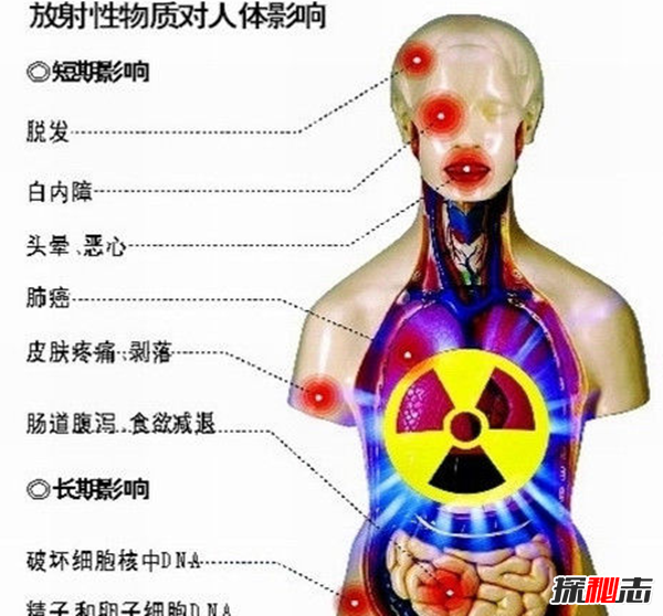 生活中哪些东西有辐射?最常见的十大放射性物品